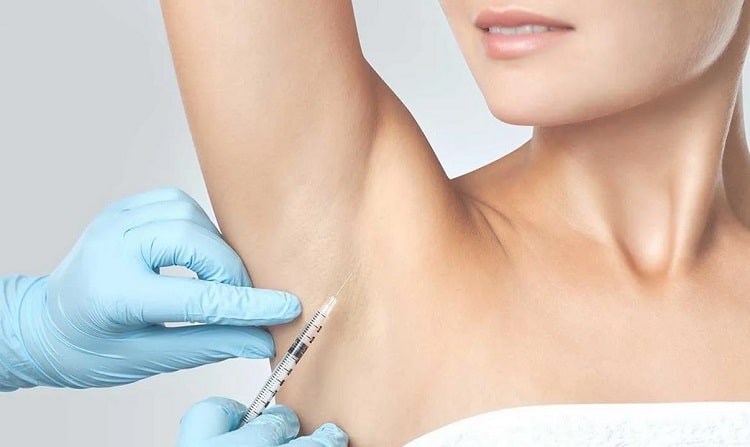 درمان تعریق بیش از حد زیر بغل با بوتاکس-کلینیک زیبایی لیزا